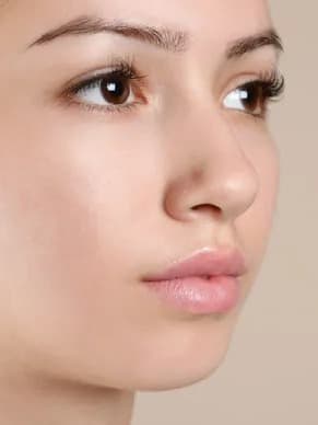 Active Acne & Breakouts treatment at Marie Jé Aesthetics in Sunnyvale