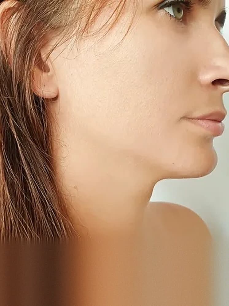 Sagging Skin & Loose Neck treatment at Marie Jé Aesthetics in Sunnyvale
