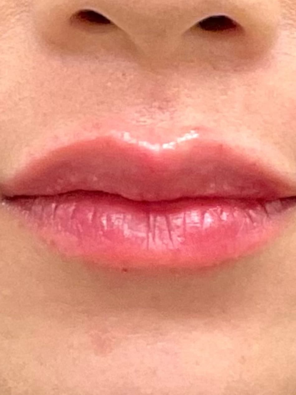 Lips after natural-looking contouring