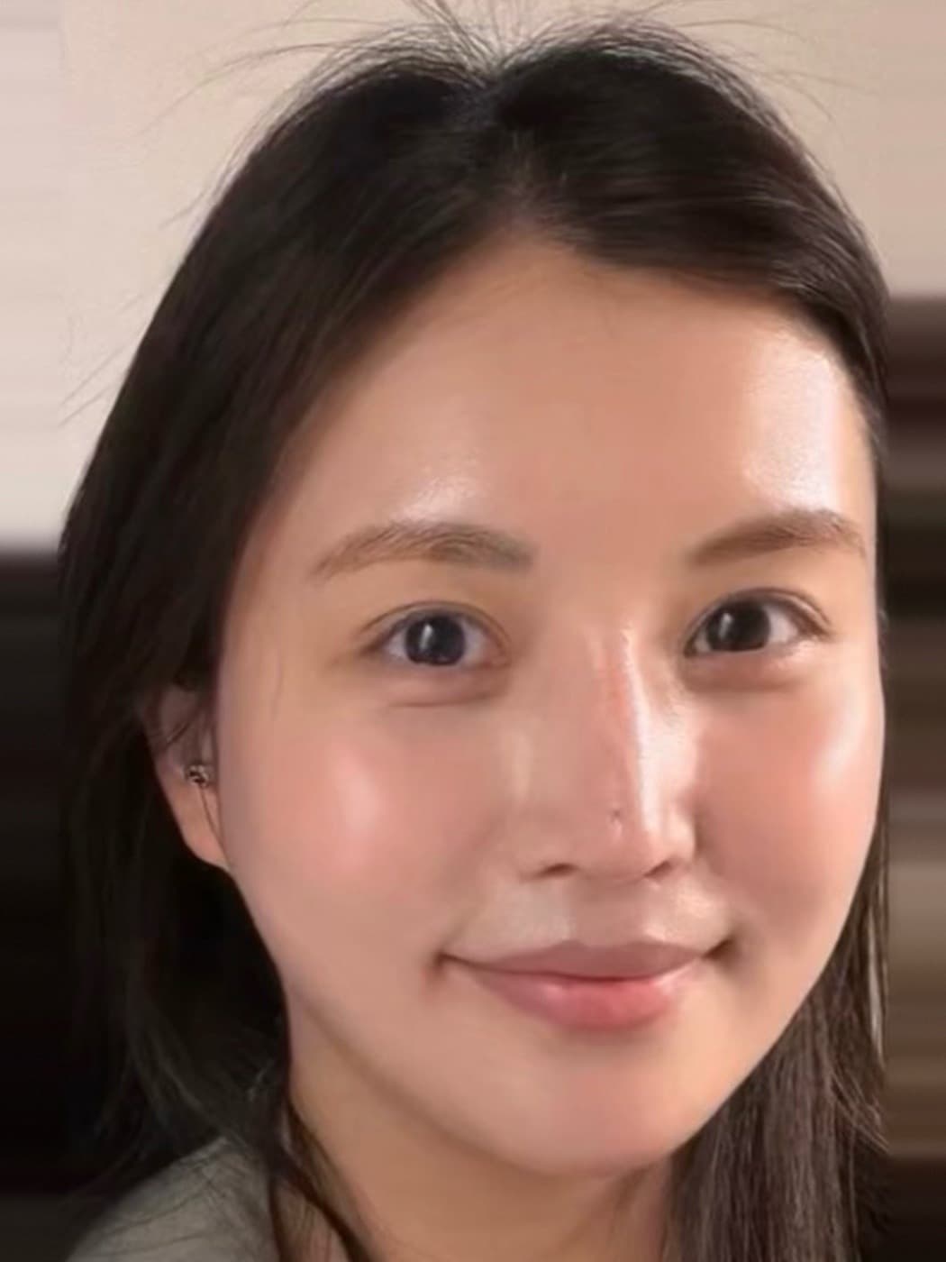Wrinkles & Fine Lines treatment at Marie Jé Aesthetics in Sunnyvale